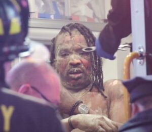 Man set on fire in Times Square; leaving him horrifically burned