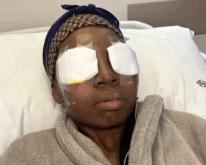 My eyes were burning - Woman hospitalised after lash extension nightmare