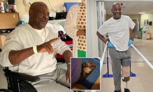 Nigerian man loses his leg after home pedicure went wrong