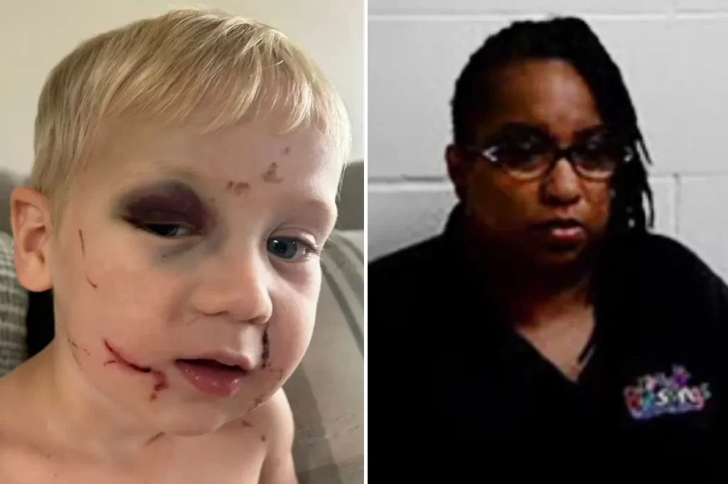 Day Care worker accused of b3ating 1-year-old ’black and blue’ released on bail