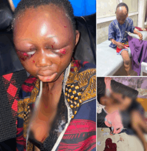Bayelsa police order mental health evaluation on Inspector who brutally assaulted his children over witchcraft allegations
