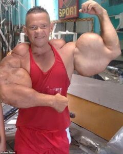Bodybuilder famed for injecting alcohol and oil into his arms d!es at 55